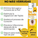 [PAGUE 1, LLEVA 2] TAG RECEDE - REMOVEDOR DE VERRUGAS